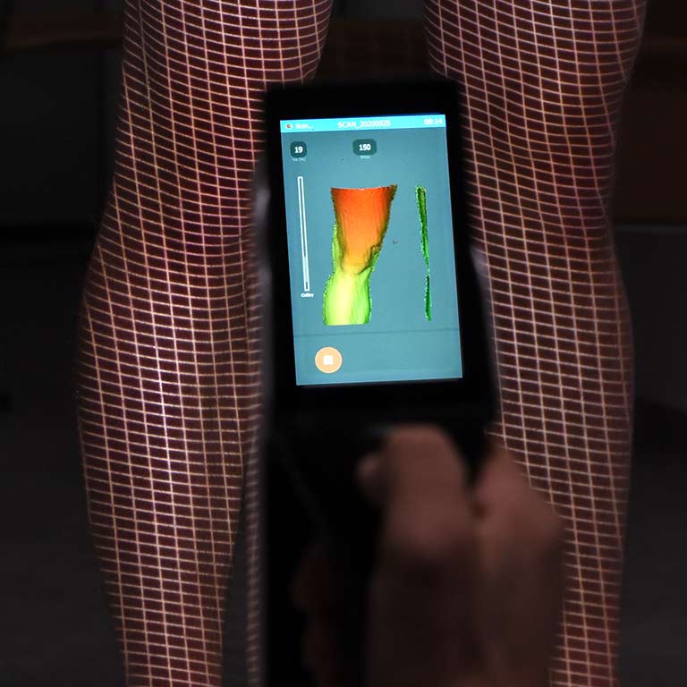 Scan vom Beim eines Patienten